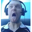 XyXersTEAM